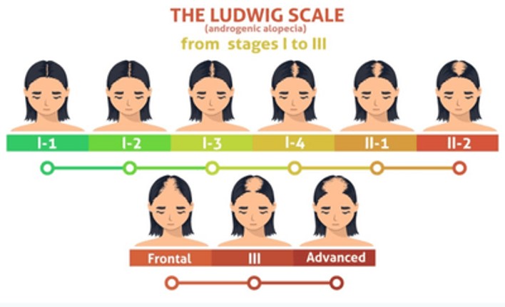 Ludwig scale