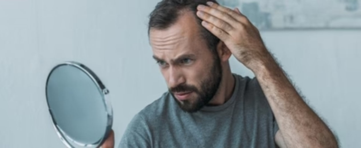 Hemochromatosis hair loss