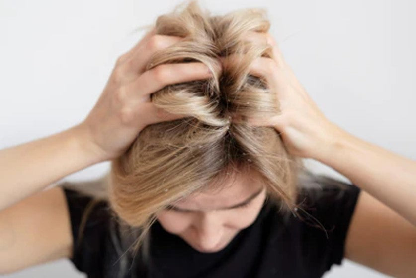 Irritation of the scalp