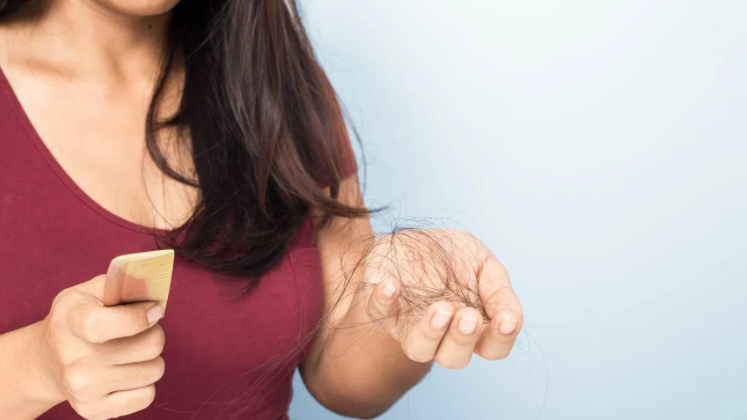 Hairloss in women